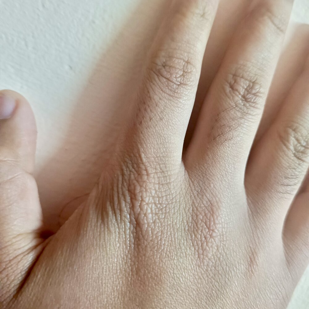 AB_KL