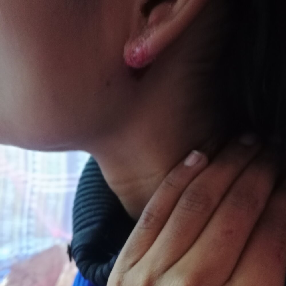 Anisha64000