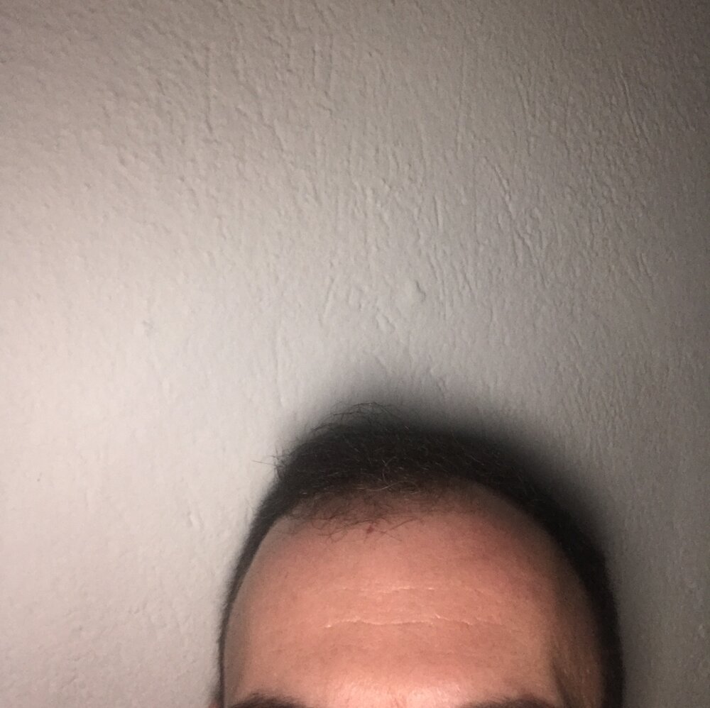Else_Albert