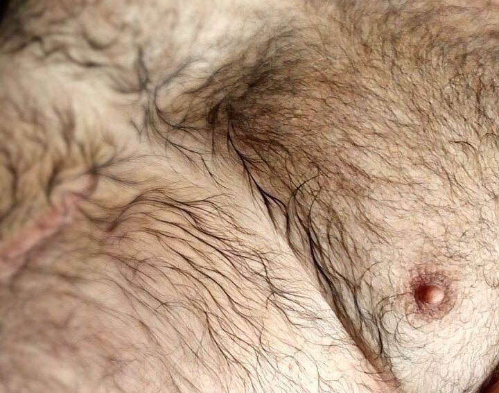 EnolicDenture