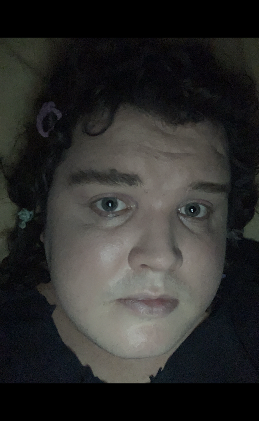 Frossst28