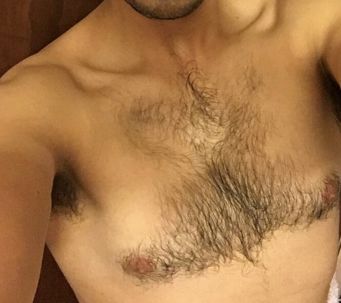 OSC18