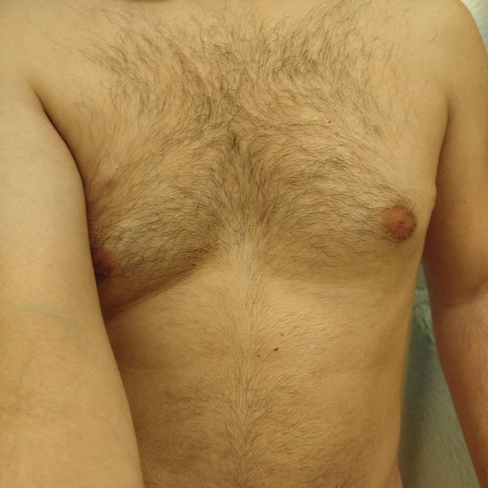 Scinca1