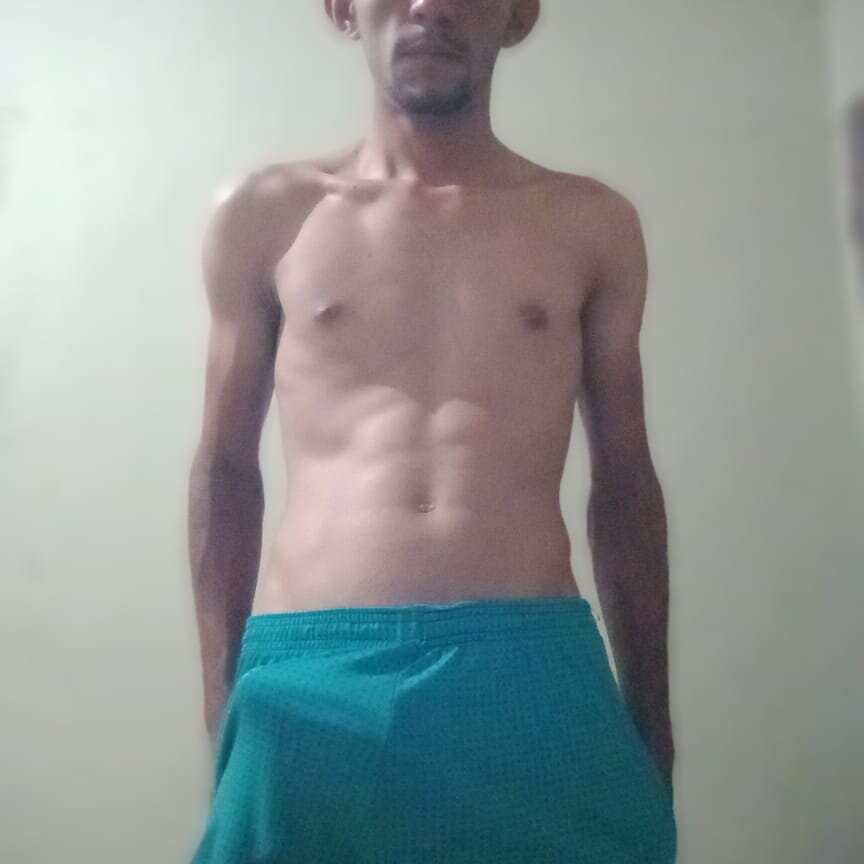 Treloso21