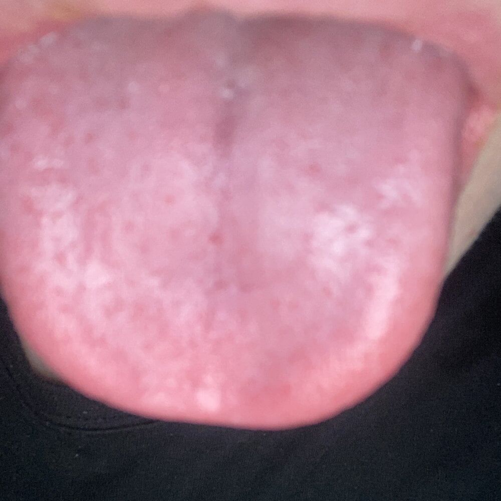 Tupapipolaco
