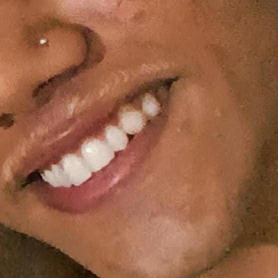 andersonlmpz
