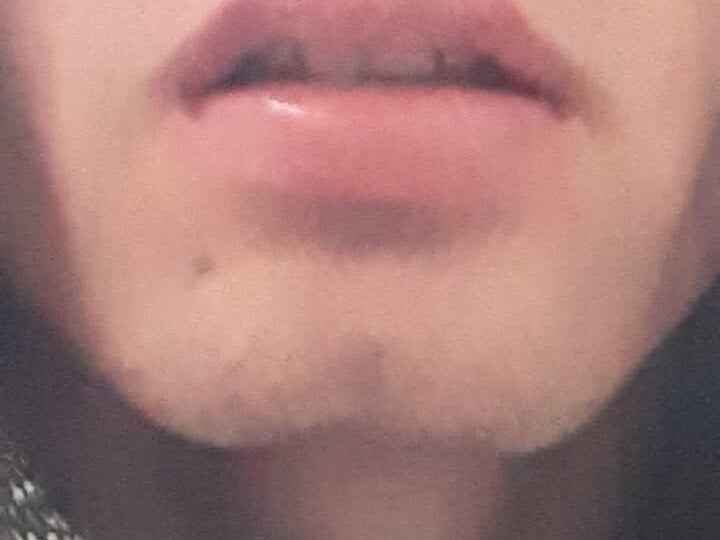 augecum