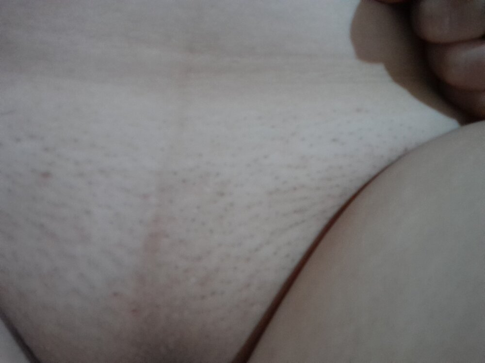 bruela