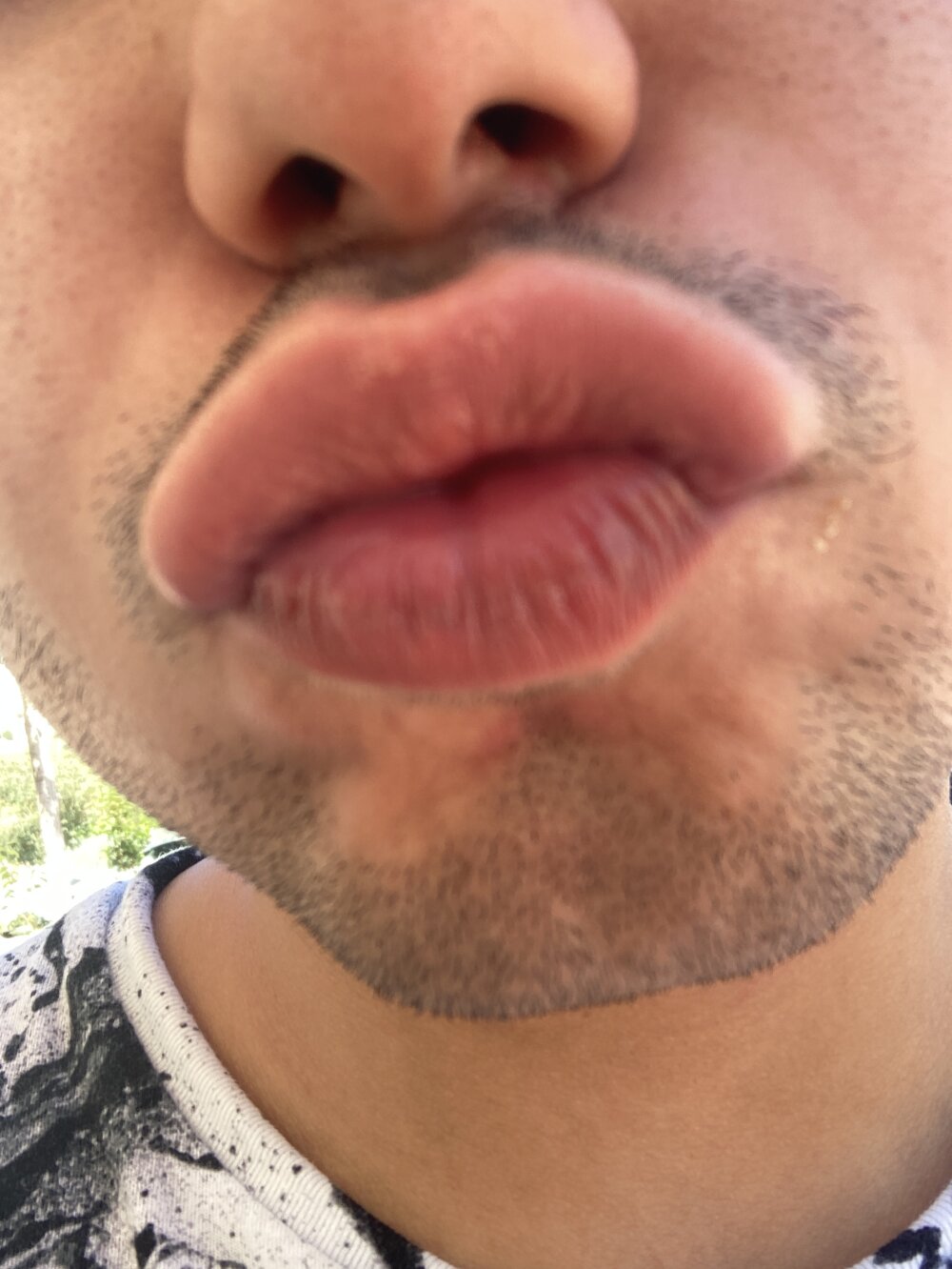 drpolla