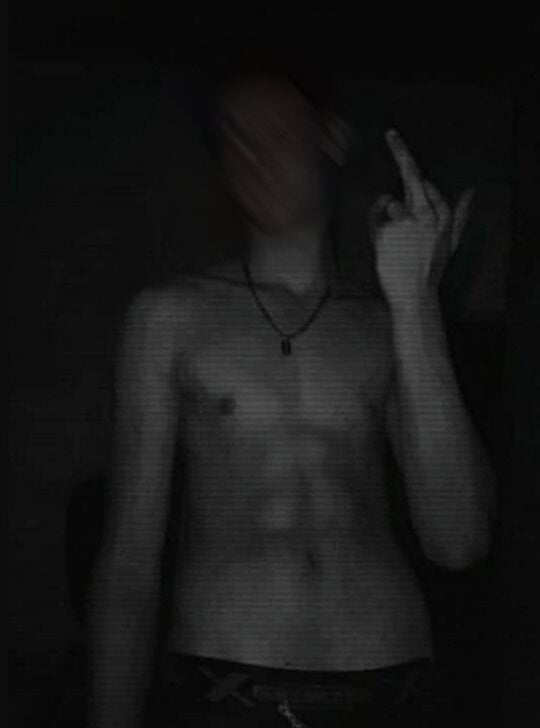 fraxxel