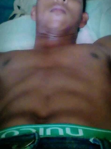 frediscoste