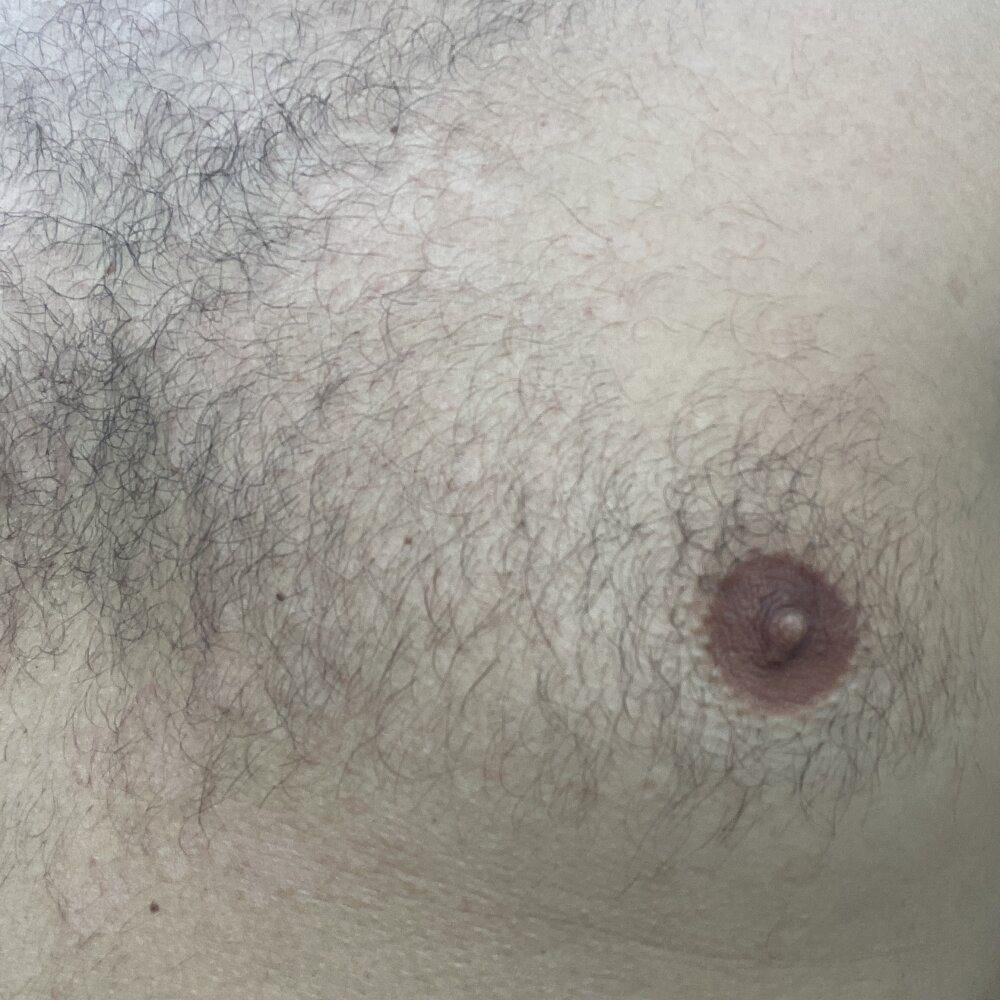 licignacio33