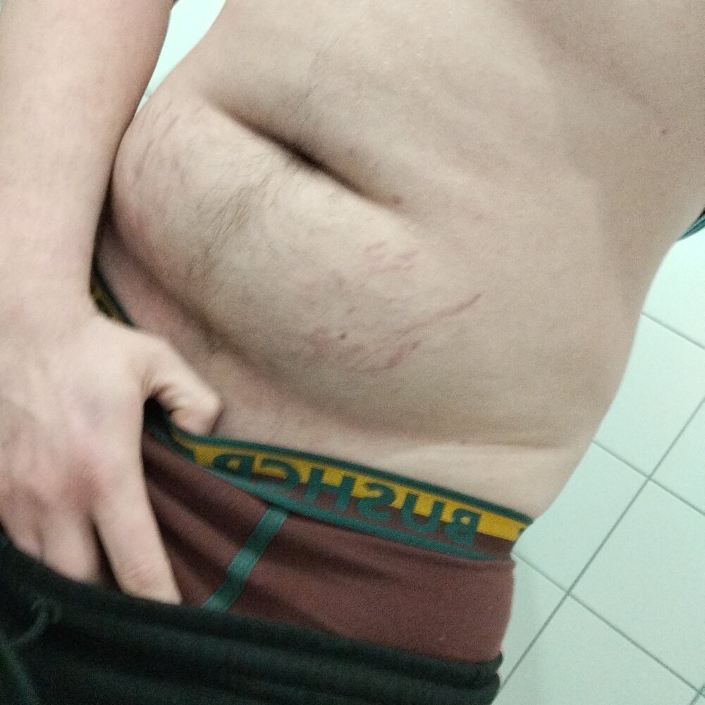 normalnyyy18cm