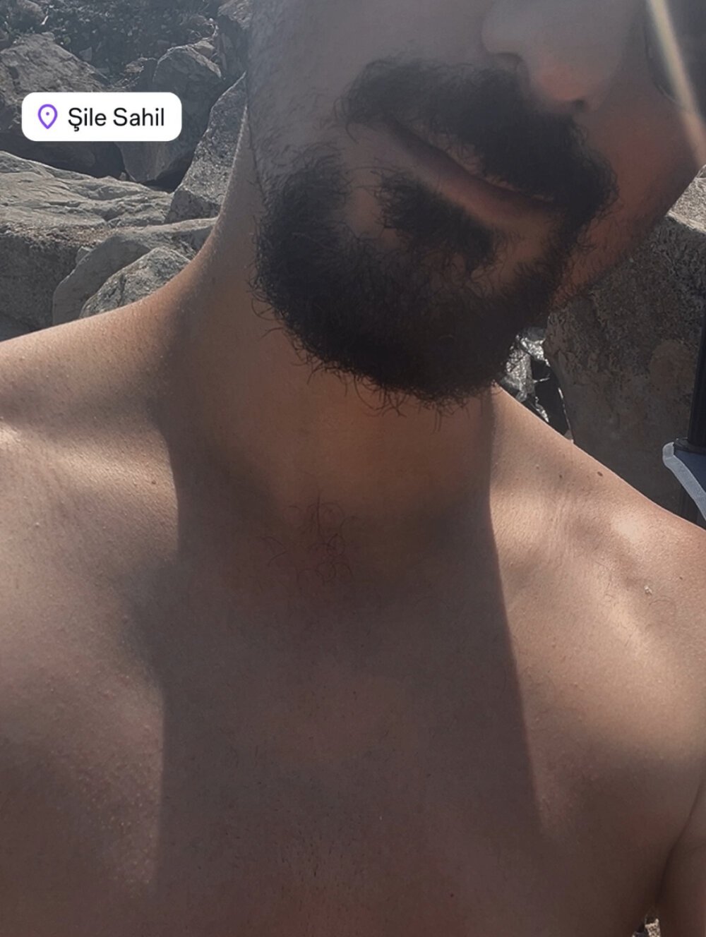 qRoqs