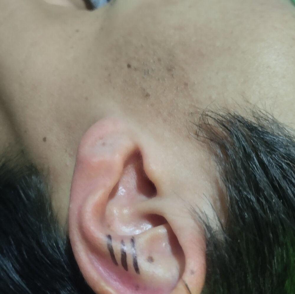 trandr