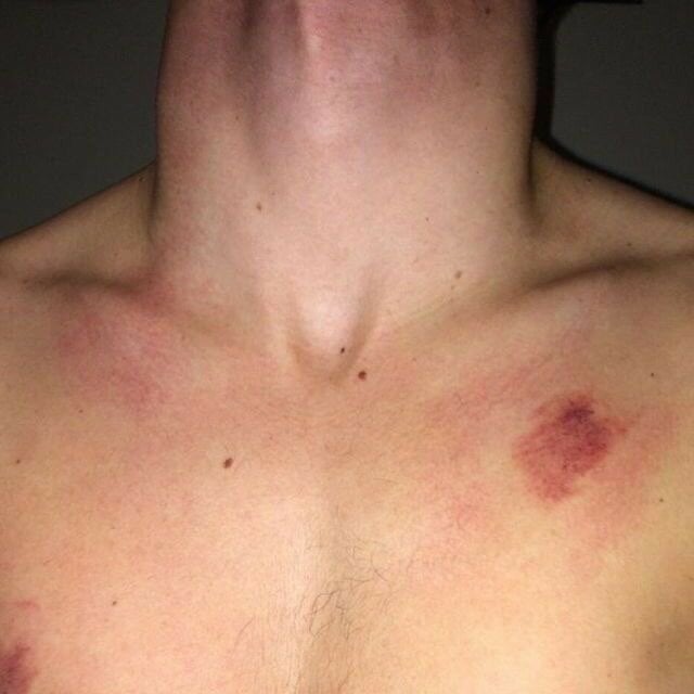 veinyCock_
