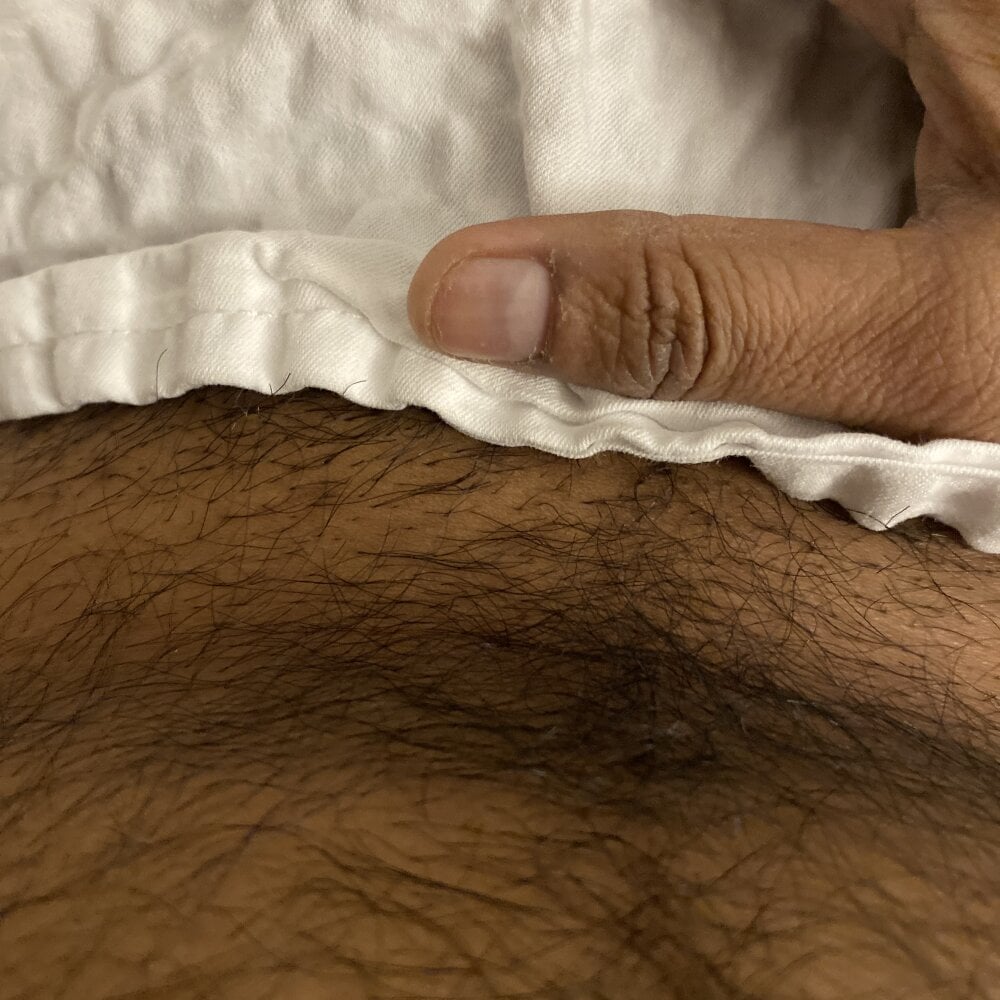 vsc7