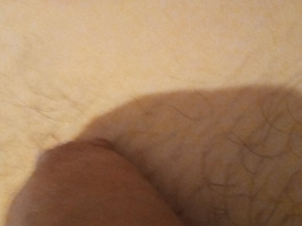 xolvo